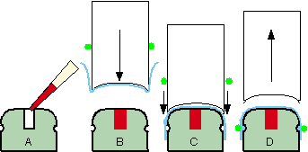 Using the dialysis button