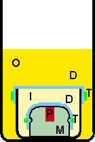 Double dialysis with button